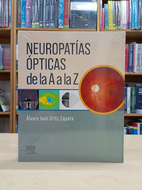 Ortiz - Neuropatías Ópticas de la A a la Z - Elsevier